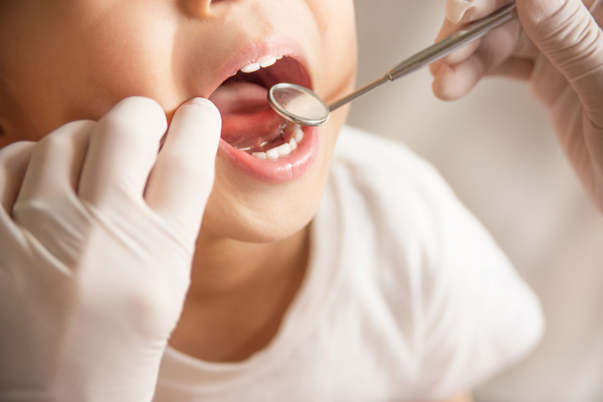 Controlli periodici e cura dei denti da latte